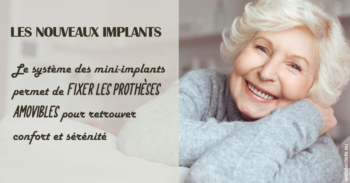 https://dr-decroos-sylvie.chirurgiens-dentistes.fr/Les nouveaux implants 1