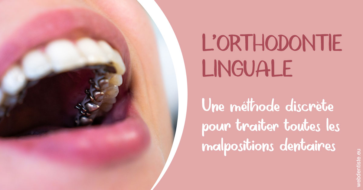 https://dr-decroos-sylvie.chirurgiens-dentistes.fr/L'orthodontie linguale 2