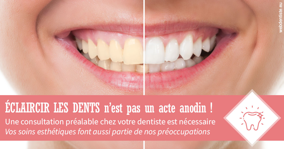 https://dr-decroos-sylvie.chirurgiens-dentistes.fr/Eclaircir les dents 1