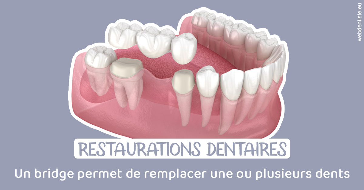 https://dr-decroos-sylvie.chirurgiens-dentistes.fr/Bridge remplacer dents 1
