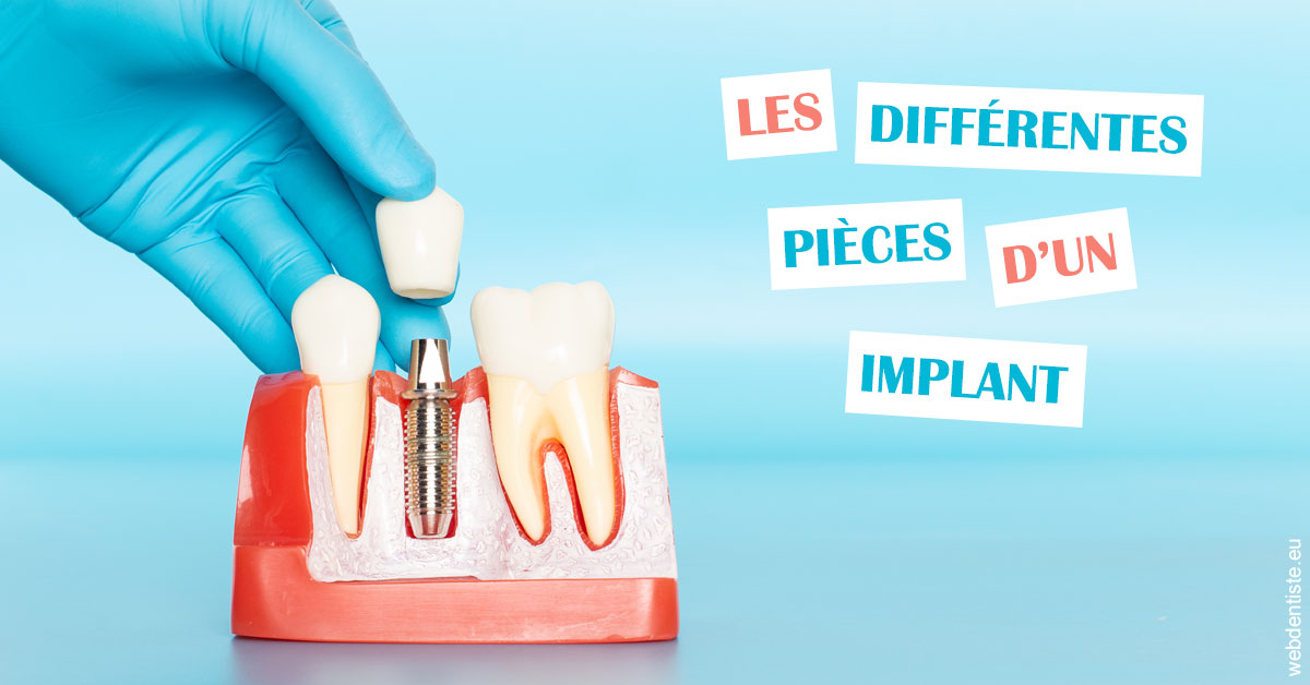 https://dr-decroos-sylvie.chirurgiens-dentistes.fr/Les différentes pièces d’un implant 2