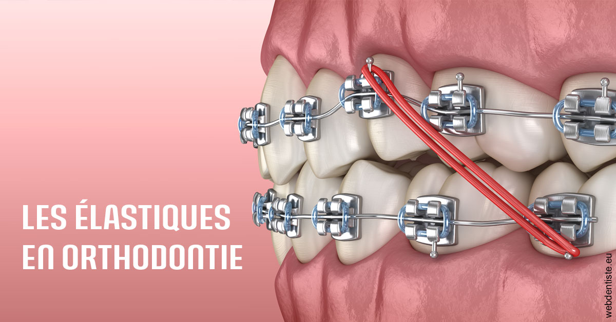 https://dr-decroos-sylvie.chirurgiens-dentistes.fr/Elastiques orthodontie 2