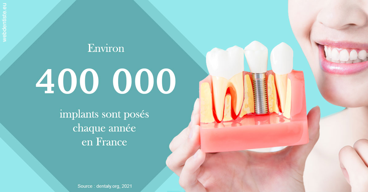 https://dr-decroos-sylvie.chirurgiens-dentistes.fr/Pose d'implants en France 2